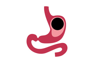 IGB image showing surgery design